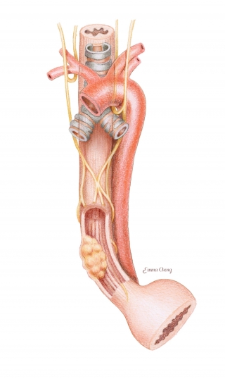 esophagus final