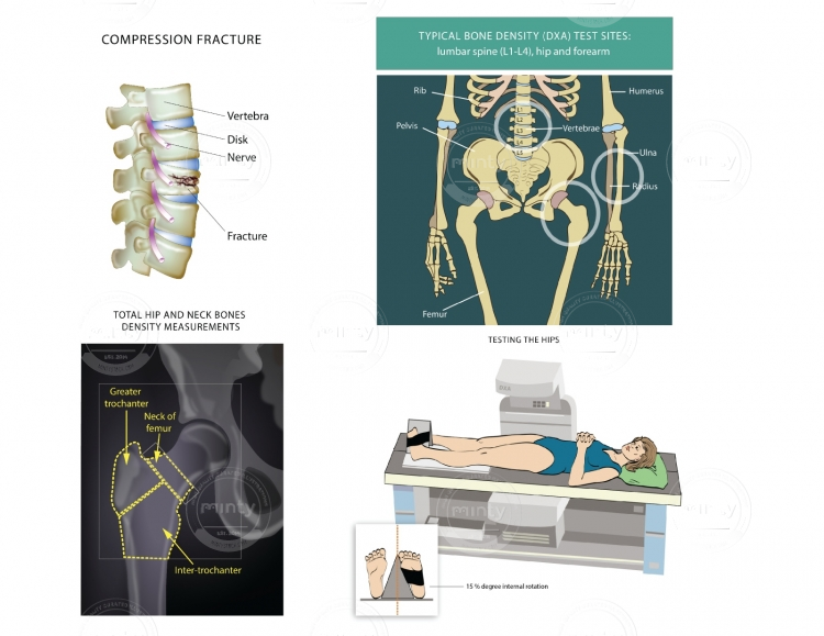 medical_illustrationsusan_szecsi-01